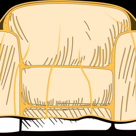 NEOPAK packaging product